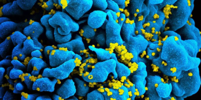 Вирус на човешкия имунодефицит (HIV)